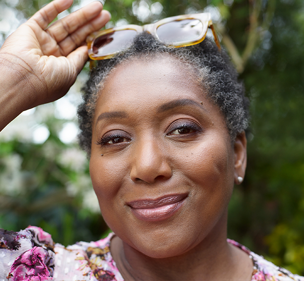 visage d'une femme noire après injection d'acide hyaluronique de Juvederm une solution anti age