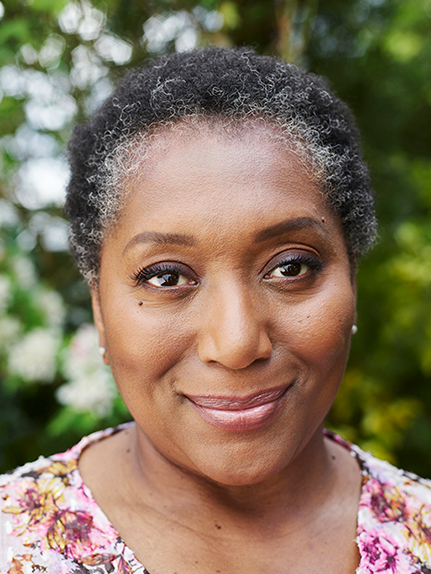 portrait d'une femme noire après injection d'acide hyaluronique anti-âge avec Juvederm