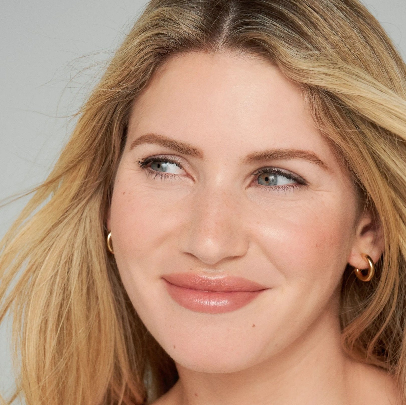 visage d'une femme avec zones d'interventions d'injection d'acide hyaluronique anti age de Juvederm