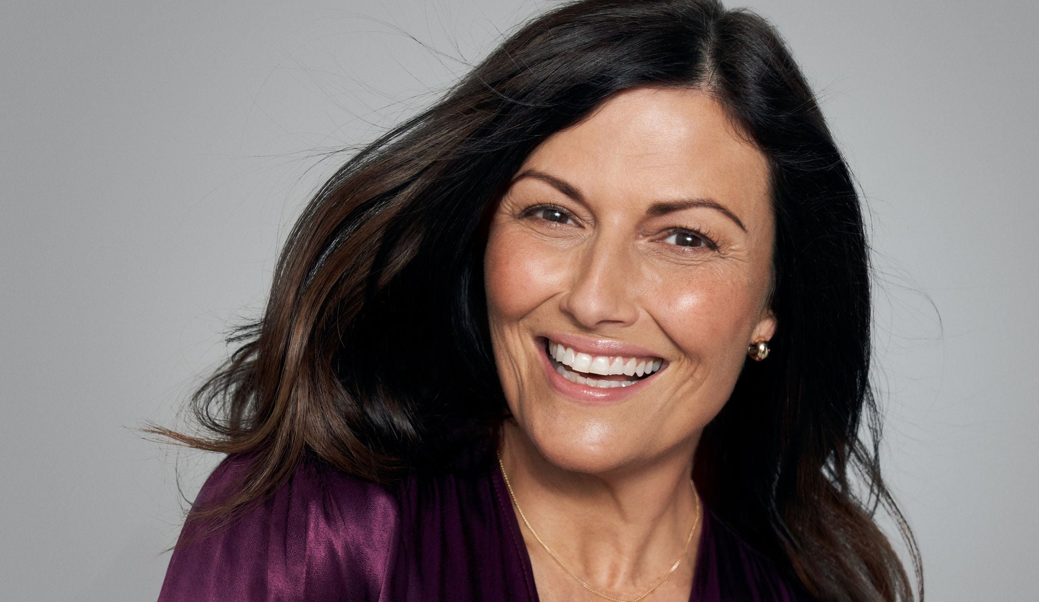 portrait d'une femme après injection d'acide hyaluronique anti-âge avec Juvederm