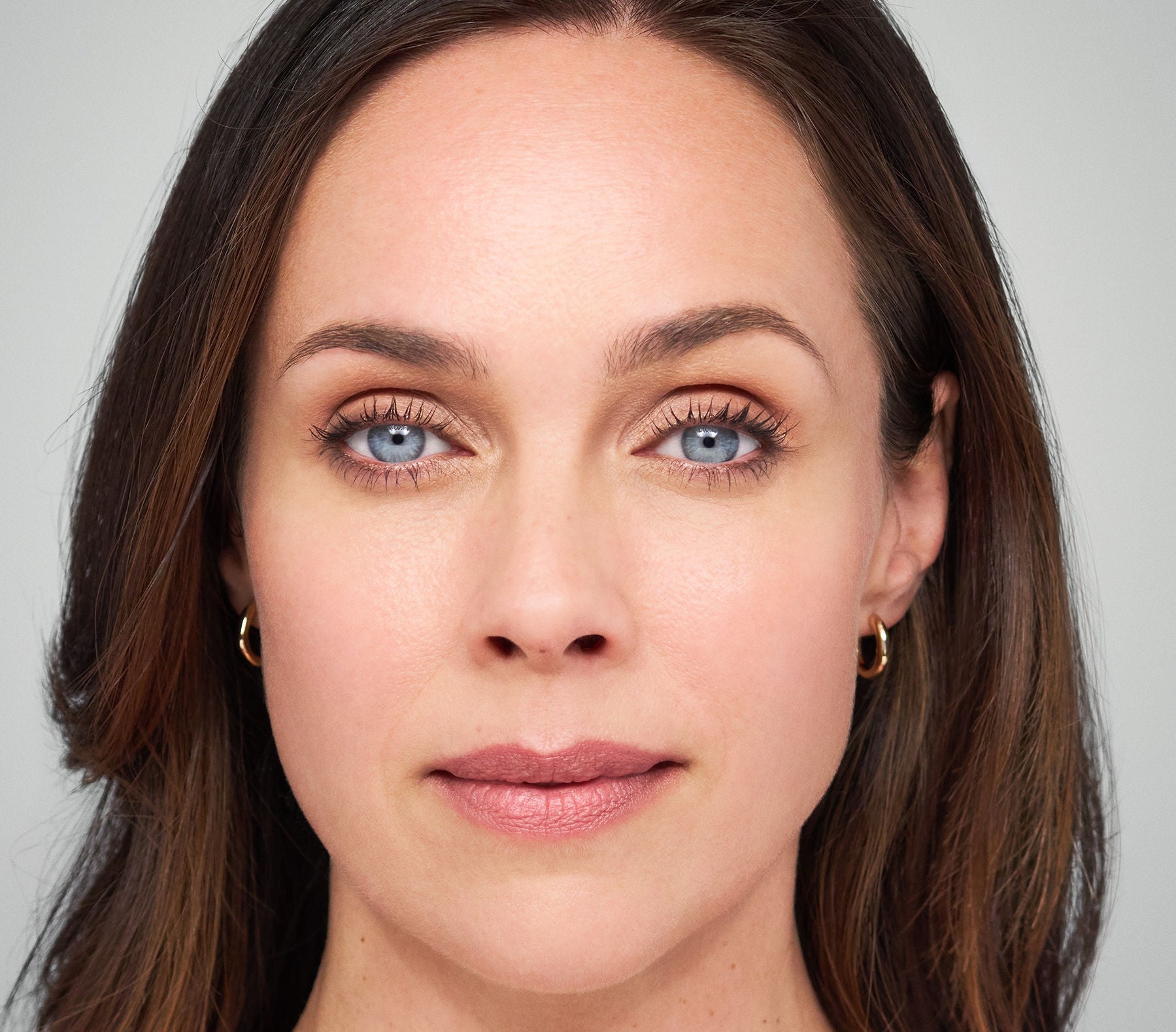 Yeux de femme après injections acide hyaluronique yeux et rides de Juvederm anti age